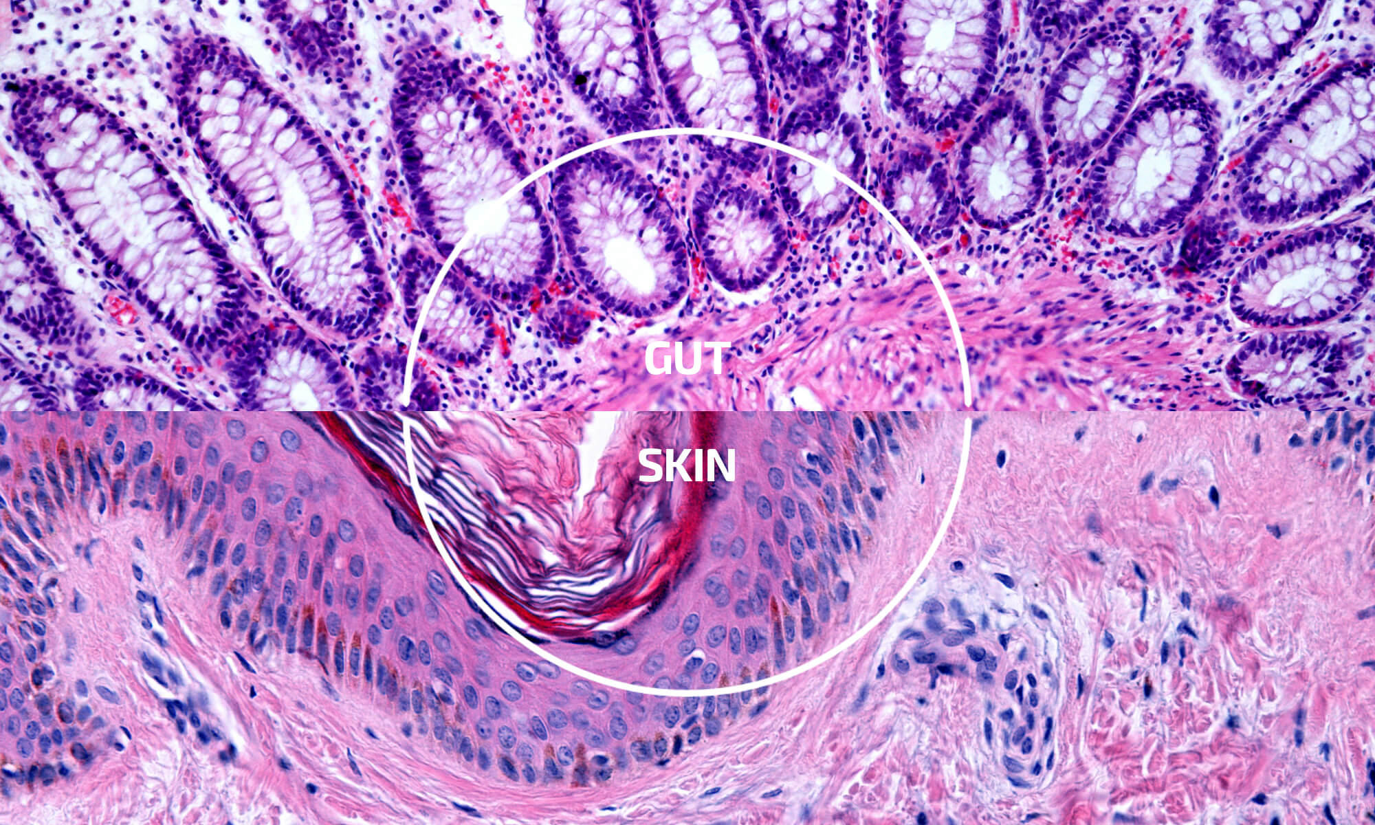 Exploring the Gut-Skin Connection: How Digestive Health Shapes Your Skin