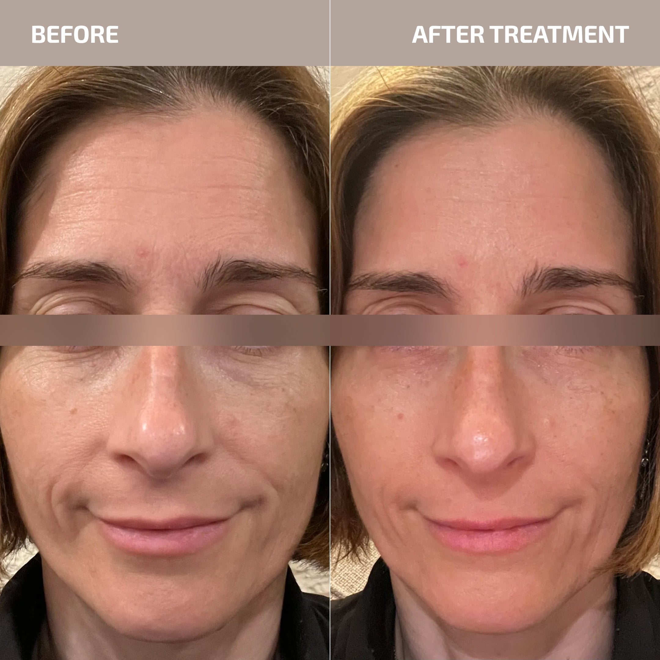 ANTÜ Refining Eye Cream