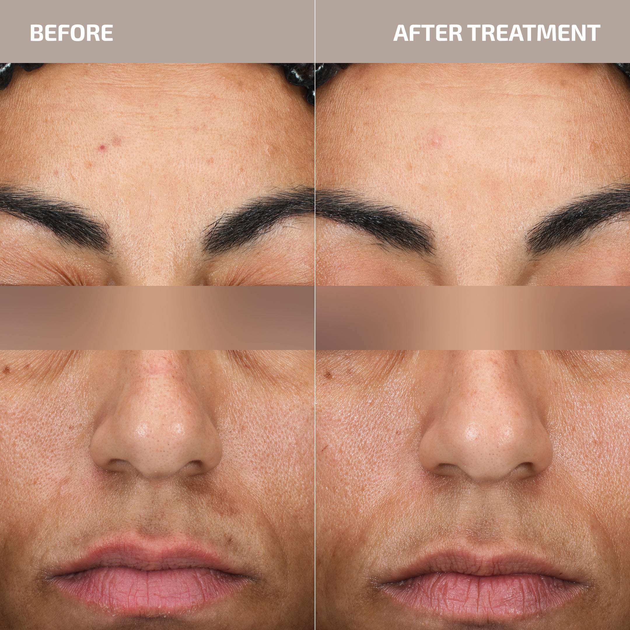 Skin Barrier Renewal Set