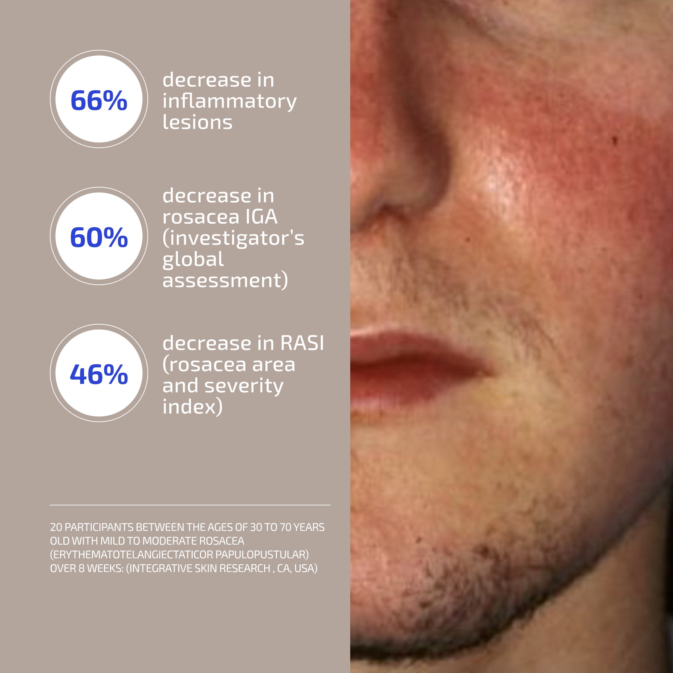 Skin Barrier Repair System