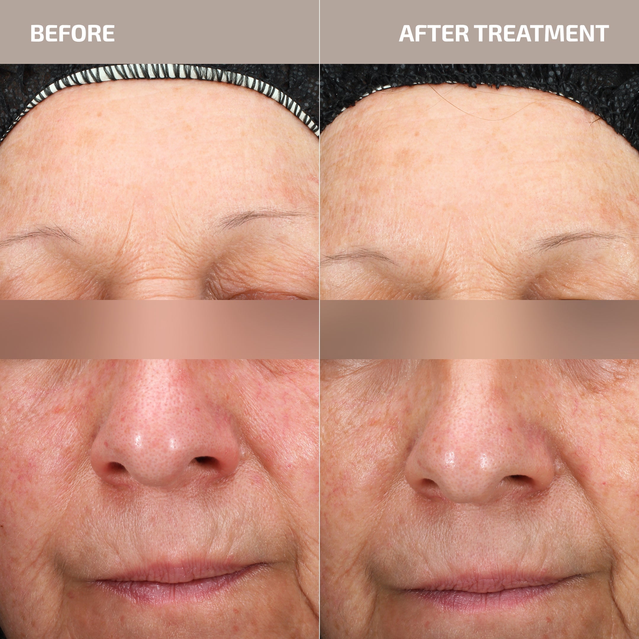 Skin Barrier Repair System