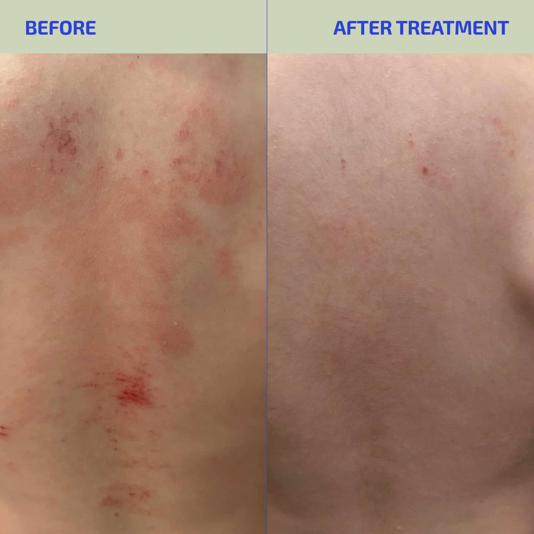 Skin Barrier Ultimate Hydrating Relief System