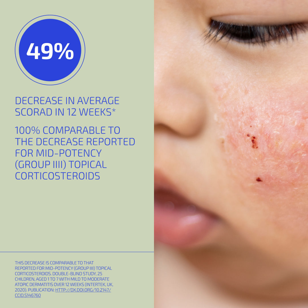 Close-up of a child's skin with a visible scar, alongside text about a 49% decrease in average scorad in 12 weeks.