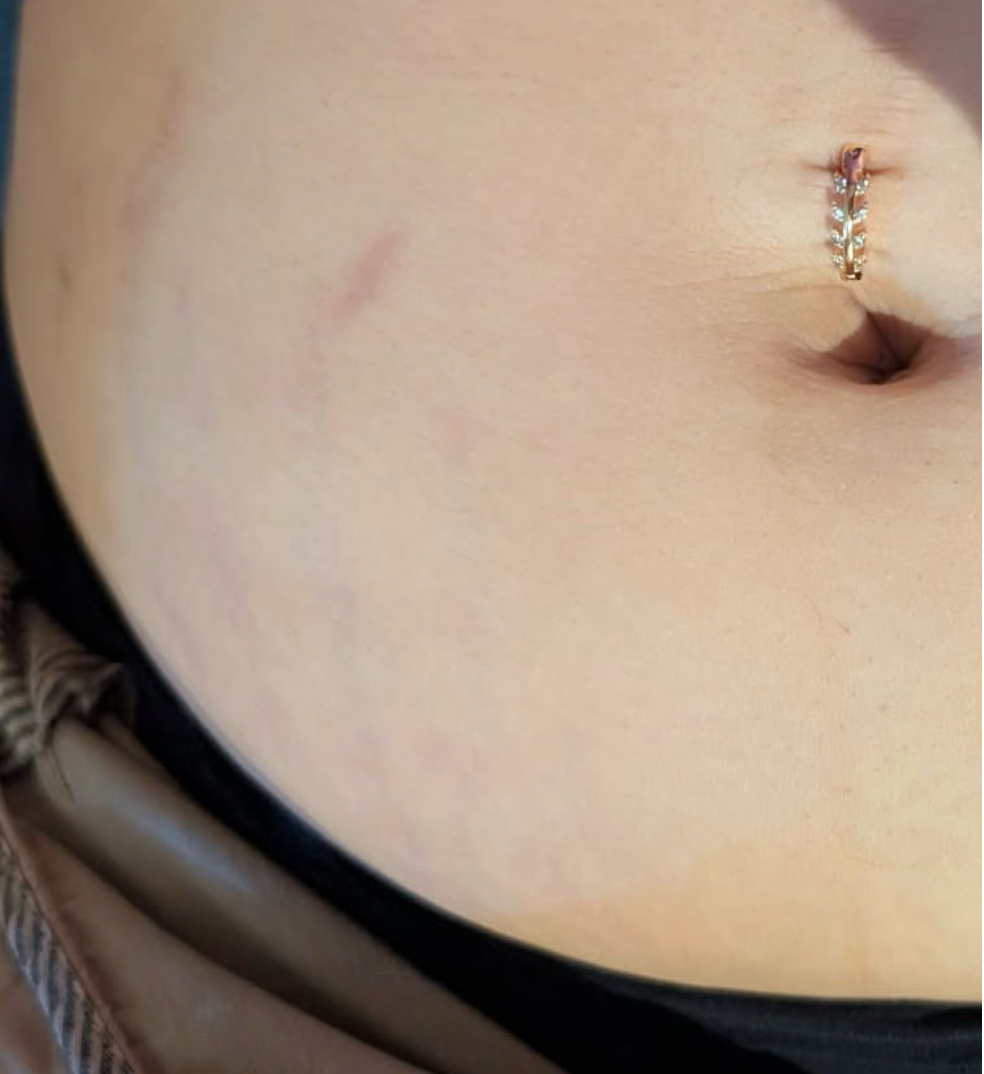 After Image