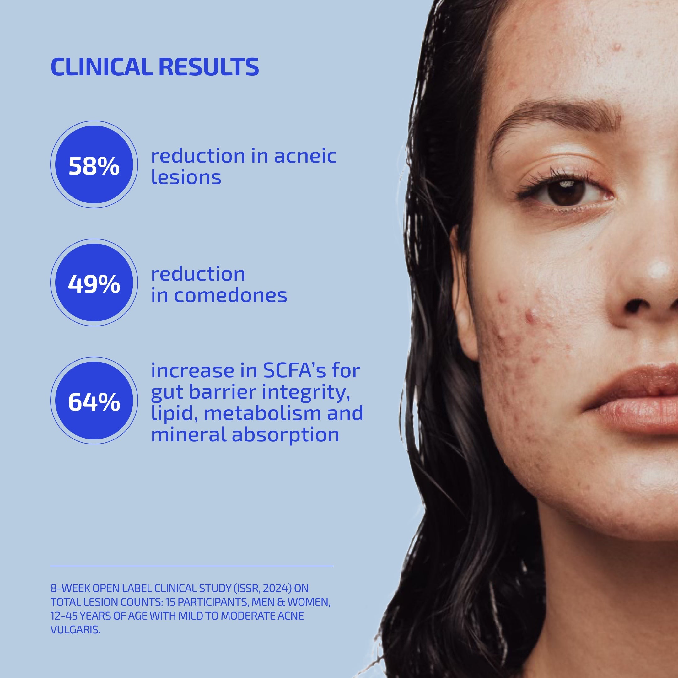 Acne & Stress Support Supplement Bundle – Probiotic + Skin De-Stress System